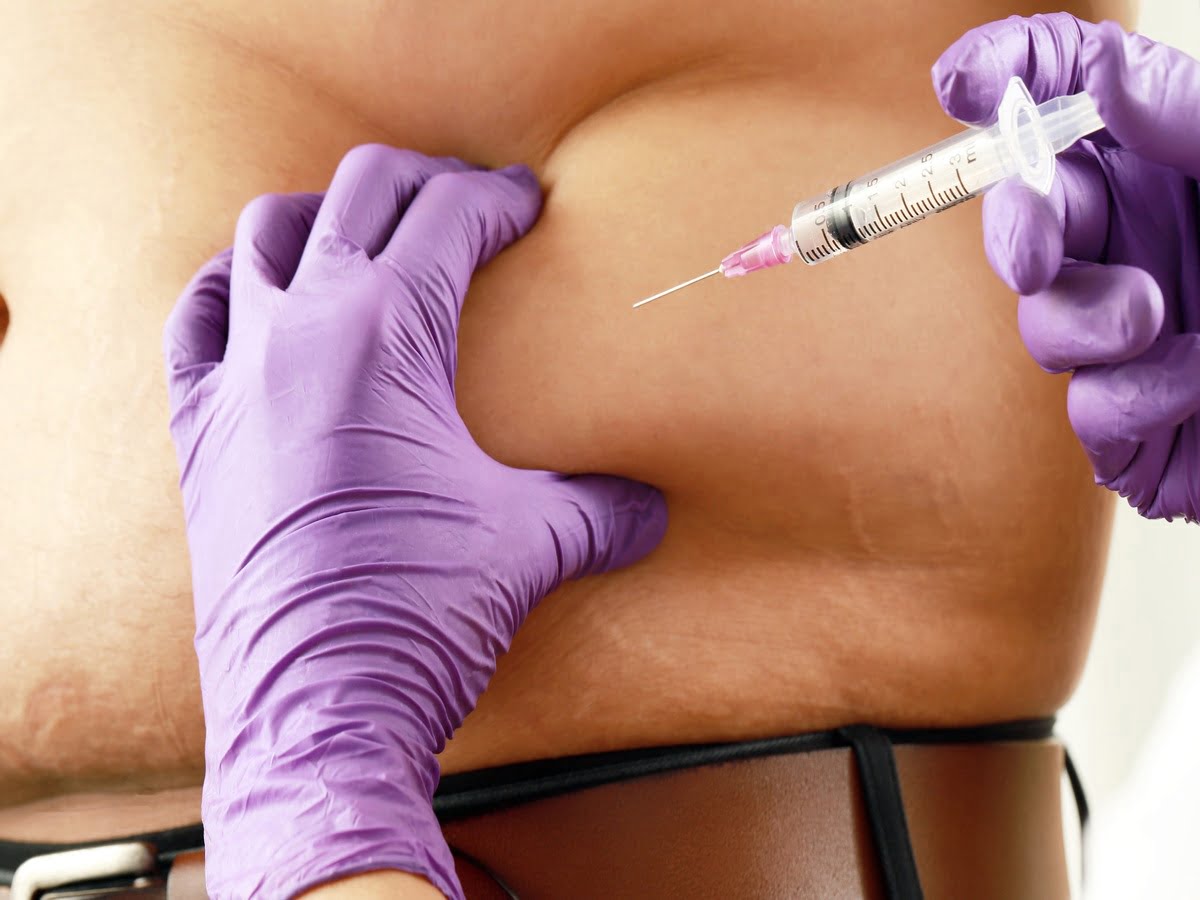 MALE FAT INJECTIONS - Everything You Need to Know
