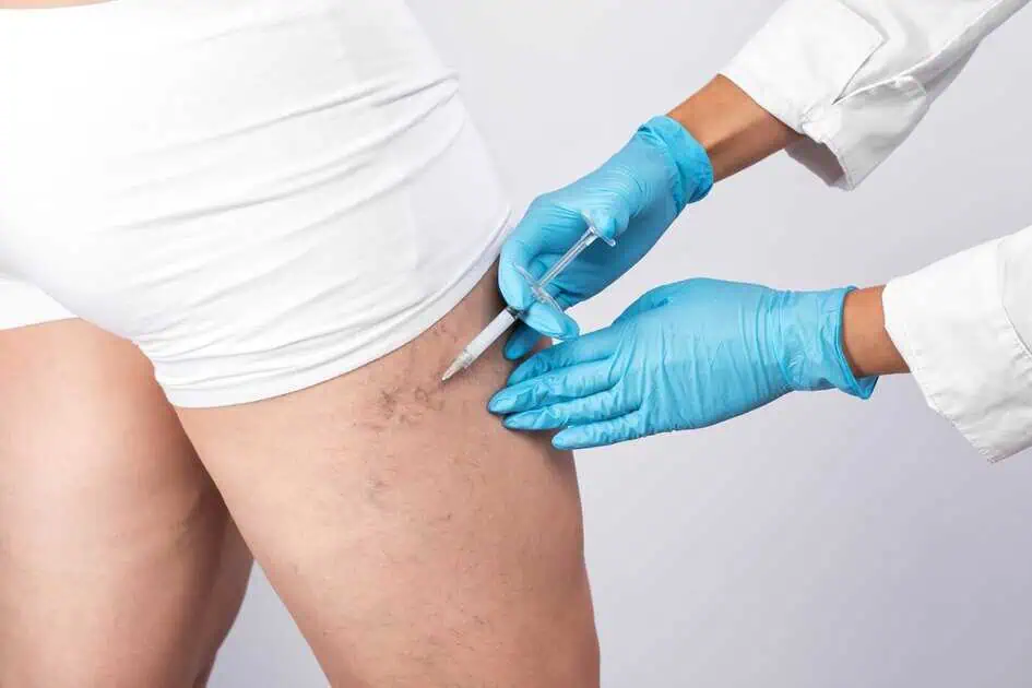 Sclerotherapy & Laser Therapy in Alpharetta, GA by The Graivier Center