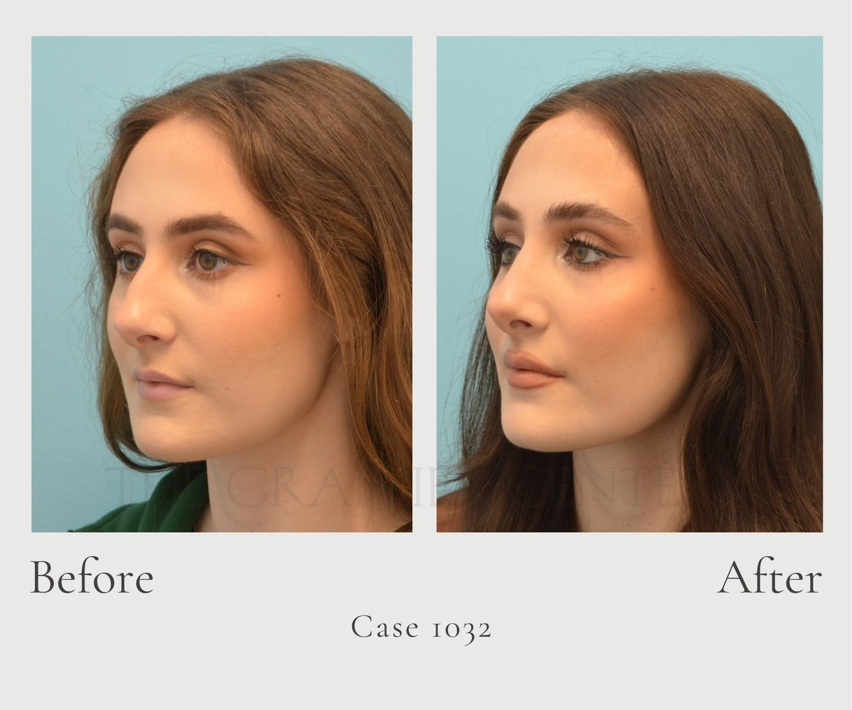 Case 1032 Closed Rhino Dr. Hill diagonal left